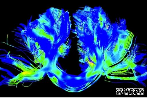 杏耀 一种帮助治疗帕金森症