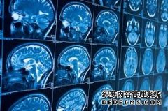 <b>大脑扫描可以揭示谁是你真正的朋友</b>
