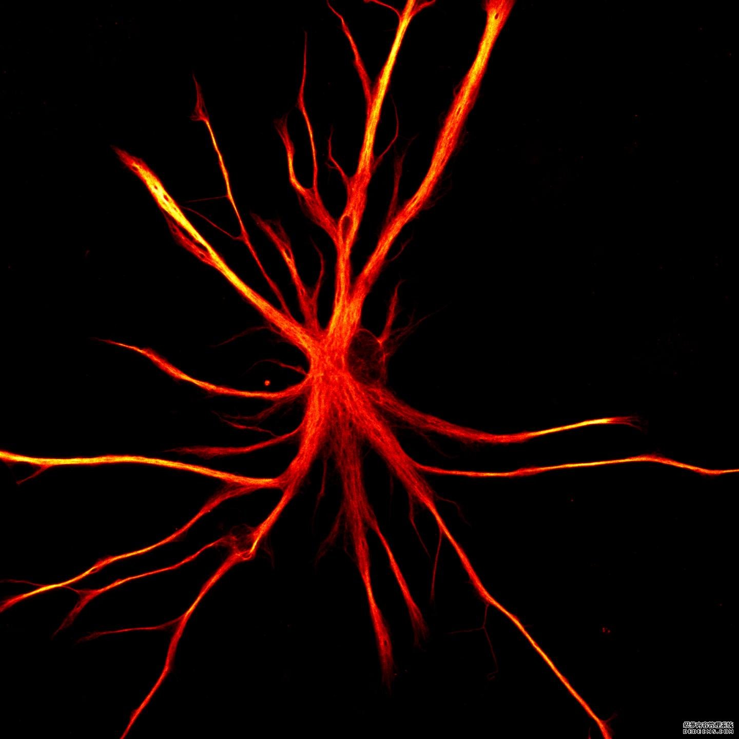 当星形胶质细胞攻击:杏耀注册帐号干细胞模型显示了神经退行性变的可能机制