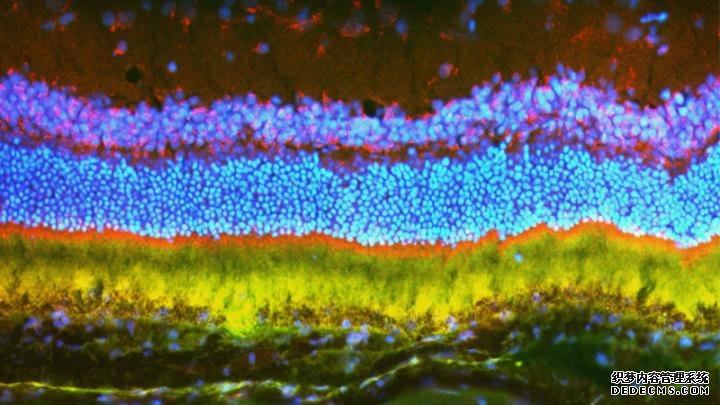 杏耀注册科学家使用纳米颗粒传递的基因疗法来抑制啮齿类动物的致盲性眼病