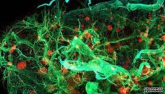 <b>巴塞罗那杏耀代理成立组织生物学和疾病建模实</b>