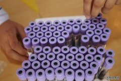 <b>研究发现普通胶水成分可用于培养造血干细胞杏</b>