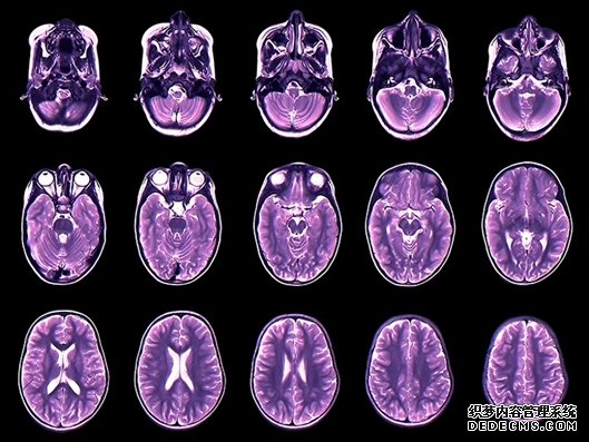 人类全生命周杏耀注册期大脑发育图绘就