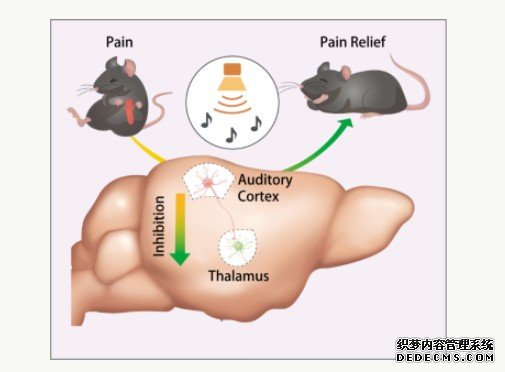 《科学》：科学家杏耀手机客户端破译“声音”减轻疼痛的原因