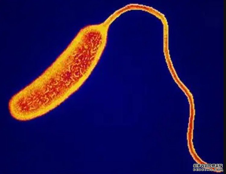 毒力基因阴性杏耀注册的霍乱菌，为啥也能致病？